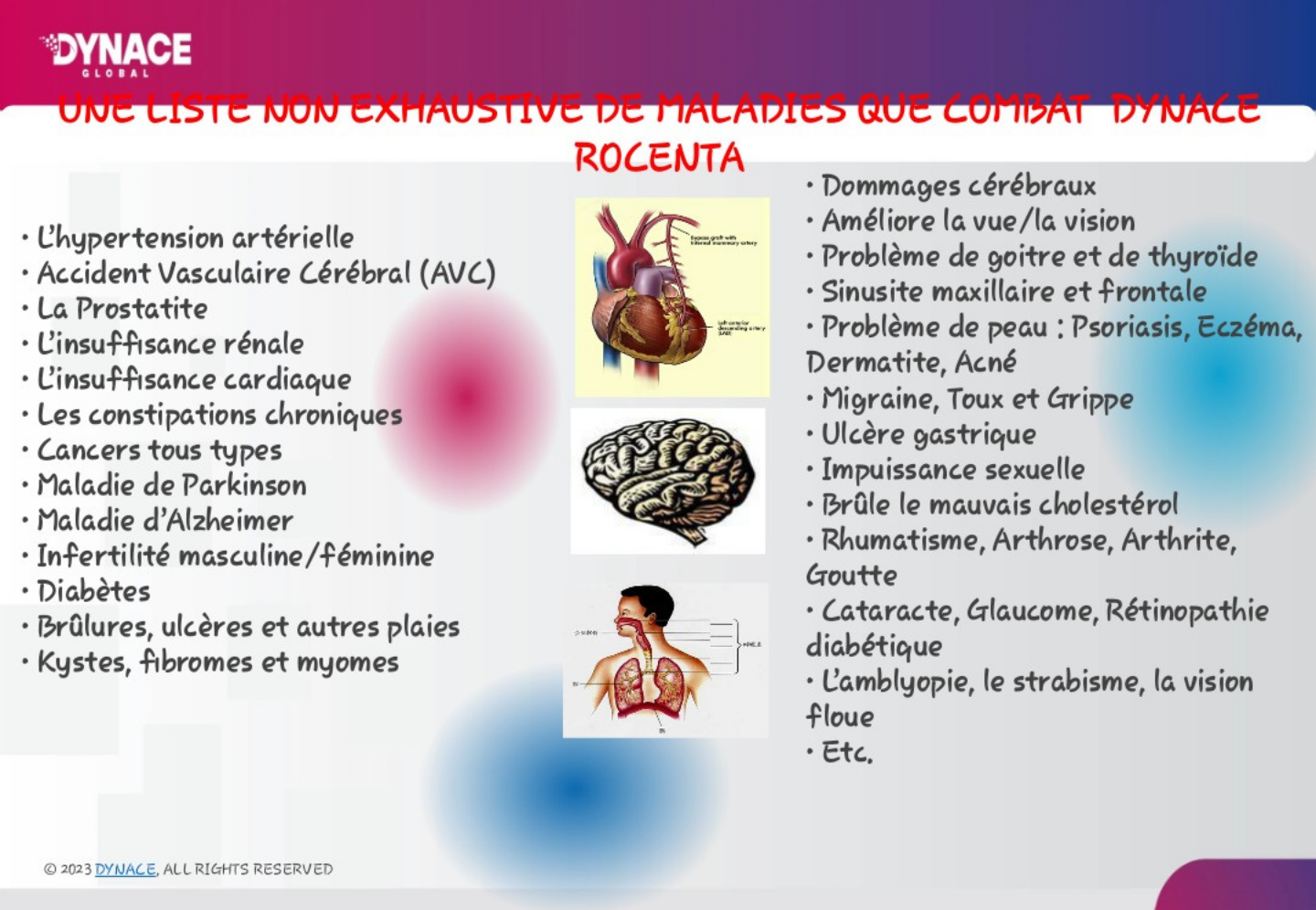 Rocenta